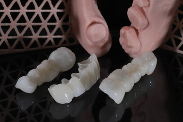Dental zirconium porcelain crowns placed on a digital model. Aesthetic visual with dental smile design. © UniqDream
