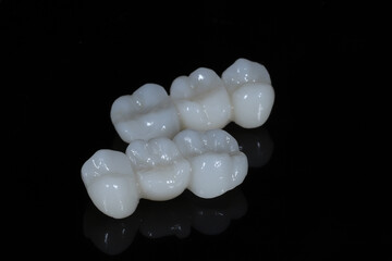 Bridge crown prosthesis treatment in dental aesthetic dentistry for missing teeth. Zirconium porcelain bridge treatment and E-max porcelain tooth coating. © UniqDream