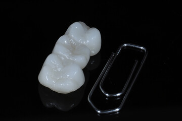 Bridge crown prosthesis treatment in dental aesthetic dentistry for missing teeth. Zirconium porcelain bridge treatment and E-max porcelain tooth coating. © UniqDream