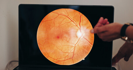 Hands, eye scan and screen in optometry for doctor, consultation and examination for vision health....