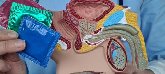 Doctor condom contraception and anatomy of male genital organs and safe sex concept