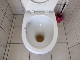 Dirty toilet with urine and traces of vomit