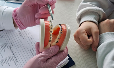 Demonstration of dental braces on a model during an orthodontic consultation for patient