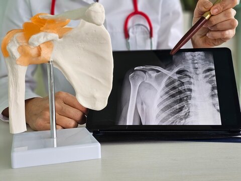 Medical professional demonstrates shoulder anatomy using a model and digital x-ray