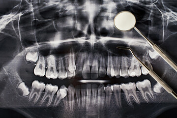 Dental x-ray and dentist tools, close-up. Panoramic x-ray radiograph of teeth for treatment