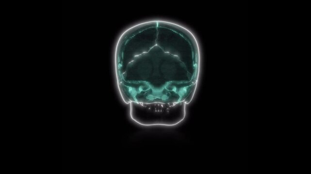 X-Ray medical brain scan loop of on black background in 4K resolution
