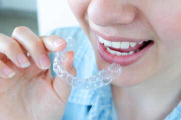 Mujer colocándose alineador invisible en sus dientes. Tratamiento de ortodoncia invisalign desde casa. 