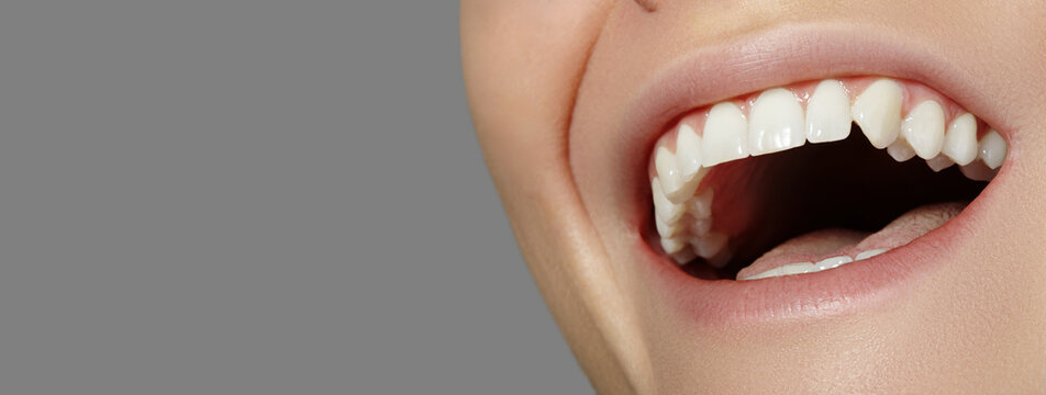 Dental Beauty. Beautiful Macro with perfect White Teeth. Whitening Tooth, Oral Hygiene, Wellness Treatment