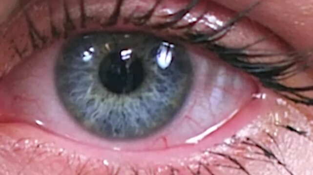 Close-up of a gray-blue woman eye with tear rolling down, showcasing intricate details of the iris, pupil, and surrounding blood vessels.