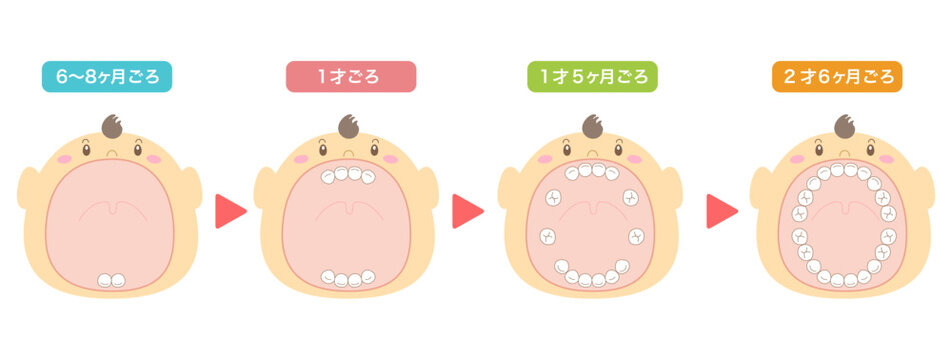 乳歯が生える時期の解説と大きな口を開けた赤ちゃんのイラスト