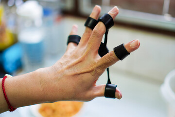 The picture shows the use of elastic bands to exercise the muscles and tendons around the finger joints to reduce trigger finger symptoms.