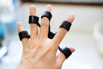 The picture shows the use of elastic bands to exercise the muscles and tendons around the finger...