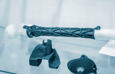Implants and prostheses printed on 3D printer from biocompatible titanium powder. Individualized...