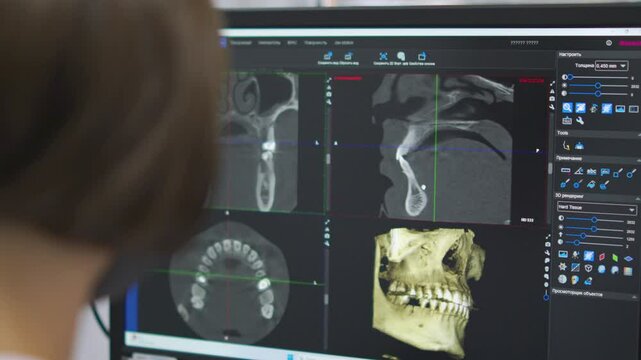dentistry. orthodontics. human jaw image. panoramic dental image. 3d. modern medical technologies. fluorography jaw image and human teeth structure in the image