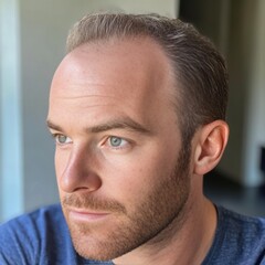 Fototapeta premium Portrait of a man with receding hairline. Concept of baldness, hair loss, hair transplant and hair grafts