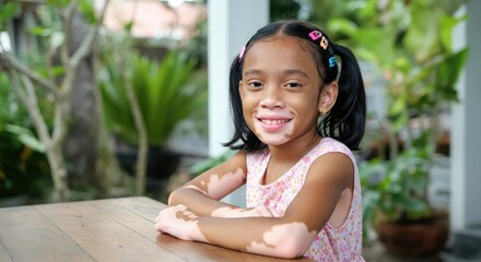 Young asian girl with vitiligo smiling in garden setting for diversity and inclusivity themes