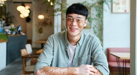 Young asian male with vitiligo smiling in modern cafe environment embracing diversity