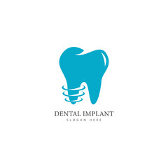 dental implant logo design concept vector  dental care logo template