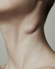 Close-up of a neck showing a noticeable lump or swelling.
