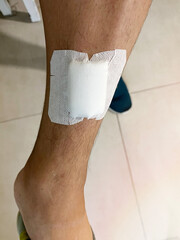 Wound on the shin