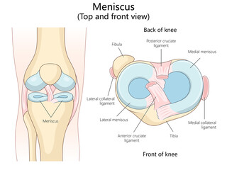 meniscus in top and front views, including ligaments and surrounding knee structures diagram hand drawn schematic raster illustration. Medical science educational illustration