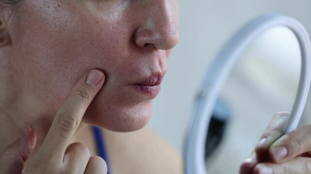 Woman in front of the mirror looking at her upper lip after depilation. Closeup. 4K.