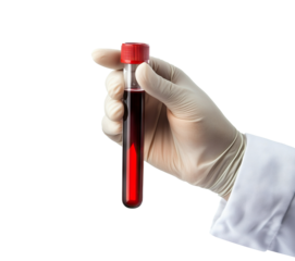 Medical blood sample tube in a doctor’s hand, isolated on transparent cutout background