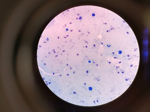 Plasmodium vivax is a protozoal parasite and a human pathogen.