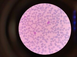 Plasmodium vivax is a protozoal parasite and a human pathogen. This parasite is the most frequent and widely distributed cause of recurring malaria.