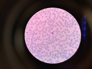 Plasmodium vivax is a protozoal parasite and a human pathogen. This parasite is the most frequent and widely distributed cause of recurring malaria.