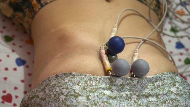 ECG machine electrodes attached to female patient's chest to record heart electrical signals at home space
