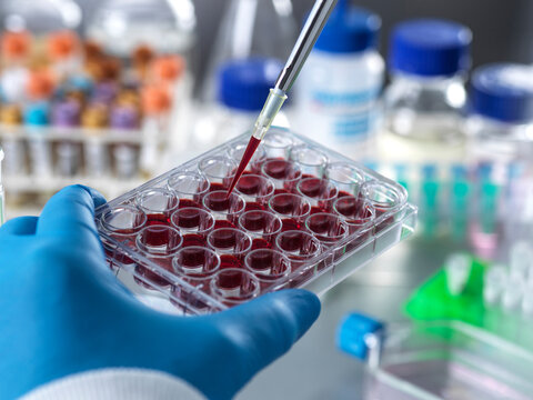 Haematology research