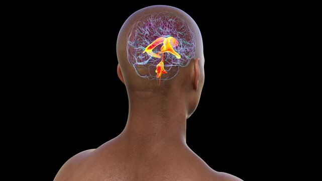 Ventricular system of brain, animation