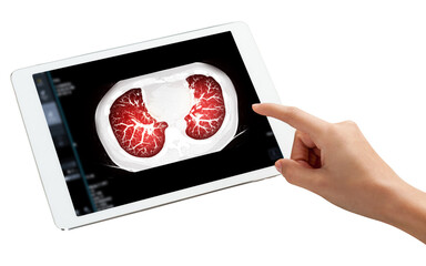 Hand Touching Tablet Display of CT Chest Scan shown on a tablet screen, with a hand pointing to the clear lung structures, emphasizing modern imaging, isolation on white background, clipping path.