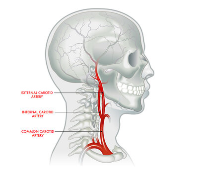 Medical illustration of carotid artery, with annotations