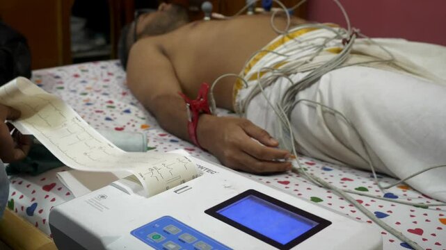ECG machine electrodes attached to patient's chest, and arms to record heart electrical signals at homely space, ECG report graph paper