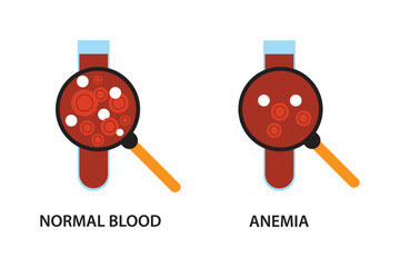 Anemia problem circulatory iron body diagram background. Anaemia biology blood isolated medical normal icon