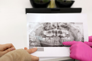 The dentist shows the patient an X-ray of the teeth, determines the method of treatment. The concept of dentistry.