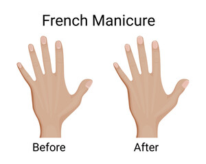 Fototapeta premium Before and after French manicure vector illustration design