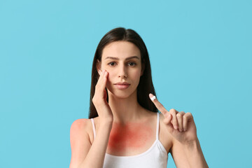 Young woman with red sunburned skin showing index finger with cream on blue background