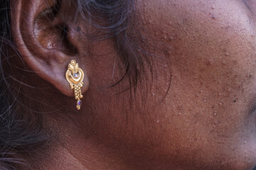 Black Young Woman With Golden Ear Piercing And Real acne Skin