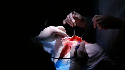 Skilled surgeons in blue scrubs perform delicate surgery in a dimly lit operating room, using...