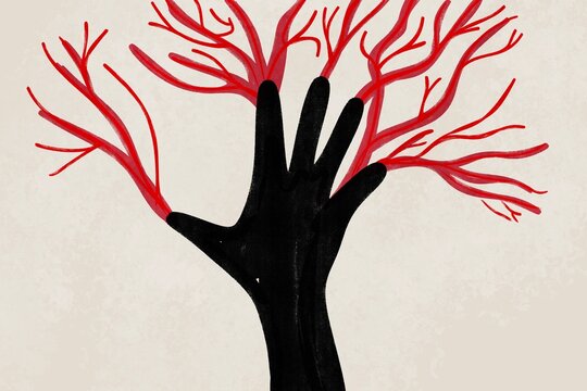 Artistic health illustration depicting a hand and veins