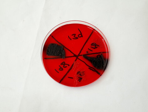 bacterial gowth on Congo red agar plate to test the ability of bacteria to broduce biofilm
