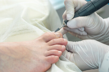 Professional hardware pedicurist, podiatrist cleaning nails using a nail miller