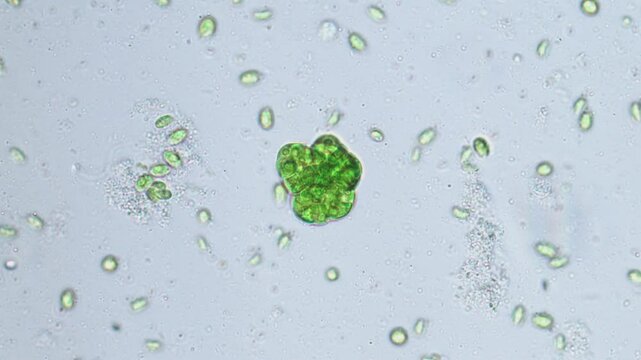 Colony of green algae in the center, protozoa under microscope magnification.