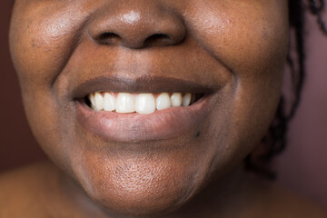 Brown skin woman with white teeth, smiling woman showing her natural white teeth