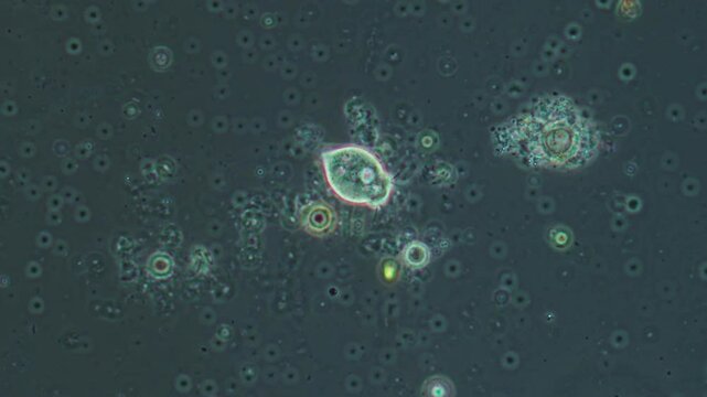 Single-celled animals under magnification microscope. The rotifer feeds on bacteria and reacts to the outside world. The world of the simplest microorganisms.