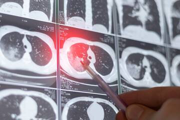 Diagnostic of X-ray or MRI scan of human lungs. Close up.