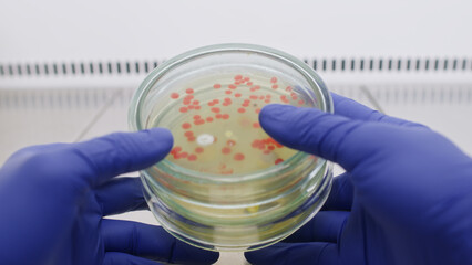 Scientist holding a shot glass in his hands Petri dishes with bacteria in hands, close-up in the...